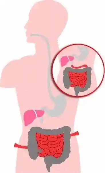 肠道微生物群在肝细胞癌发病机制中的作用