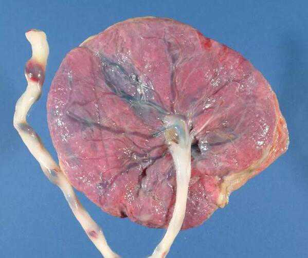 研究发现：补维生素A，或能减缓脱发、促进毛发再生和伤口愈合？