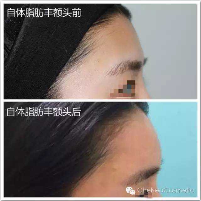 覆盖90%人体组织和器官，闵行这家生物3D打印企业“很科幻”